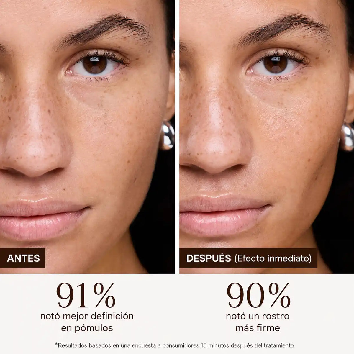 SkinCare Pro™ - Tonificador Facial Microcorriente